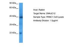 DNAJC12 Rabbit anti-Human, Polyclonal, Novus Biologicals 0.1 mL | Buy Online | Novus Biologicals | Fisher Scientific